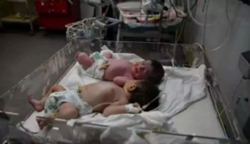 Gazze'de 2 Bebek Açlıktan Hayatını Kaybetti!