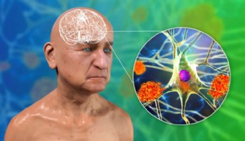 FTD Demansı Alzheimer İle Karıştırmayın!